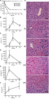 Quantitative Proteomic Analysis Reveals That Arctigenin Alleviates Concanavalin A-Induced Hepatitis Through Suppressing Immune System and Regulating Autophagy